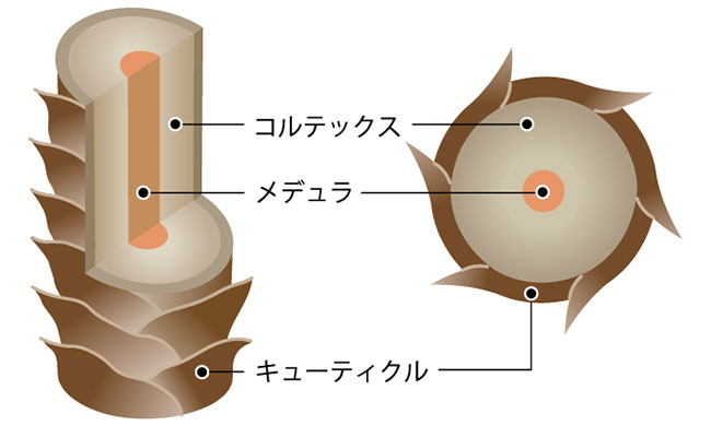 痛む原因2